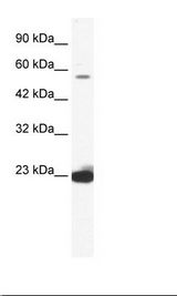 Jurkat Cell Lysate