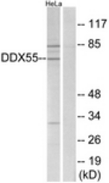 Western blot of extracts from HeLa cells, using DDX55 Antibody. The lane on the right is treated with the synthesized peptide.