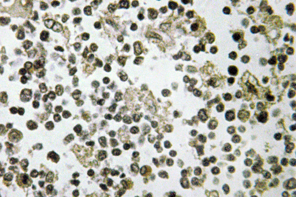 IHC of DDX55 (Q133) pAb in paraffin-embedded human lymph node tissue.