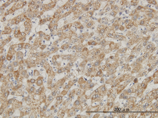 Immunoperoxidase of monoclonal antibody to DDX56 on formalin-fixed paraffin-embedded human liver. [antibody concentration 3 ug/ml]