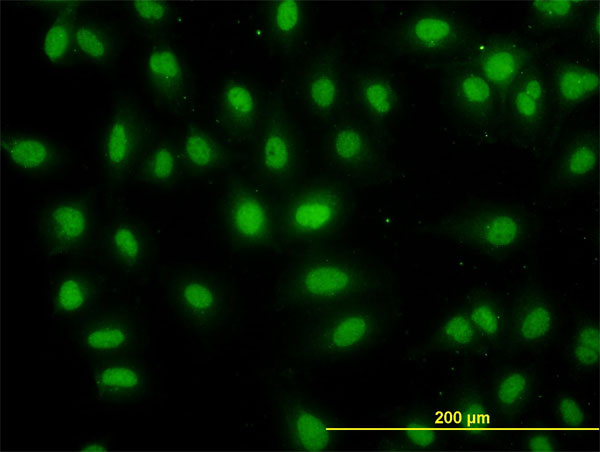 Immunofluorescence of monoclonal antibody to DDX56 on HeLa cell. [antibody concentration 10 ug/ml]
