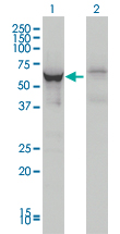 Western blot of DDX56 expression in transfected 293T cell line by DDX56 monoclonal antibody (M05), clone 4C5.