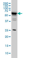DDX56 monoclonal antibody (M05), clone 4C5 Western blot of DDX56 expression in HeLa.