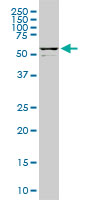 DDX56 monoclonal antibody (M05), clone 4C5. Western blot of DDX56 expression in PC-12.