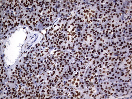 IHC of paraffin-embedded Human pancreas tissue using anti-DDX56 mouse monoclonal antibody. (Heat-induced epitope retrieval by 10mM citric buffer, pH6.0, 120°C for 3min).