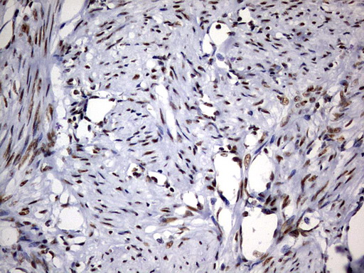 IHC of paraffin-embedded Human endometrium tissue using anti-DDX56 mouse monoclonal antibody. (Heat-induced epitope retrieval by 10mM citric buffer, pH6.0, 120°C for 3min).