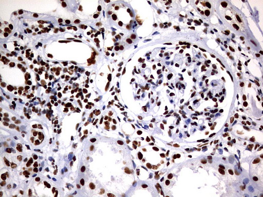 IHC of paraffin-embedded Human Kidney tissue using anti-DDX56 mouse monoclonal antibody. (Heat-induced epitope retrieval by 10mM citric buffer, pH6.0, 120°C for 3min).