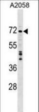 DDX56 Antibody western blot of A2058 cell line lysates (35 ug/lane). The DDX56 antibody detected the DDX56 protein (arrow).