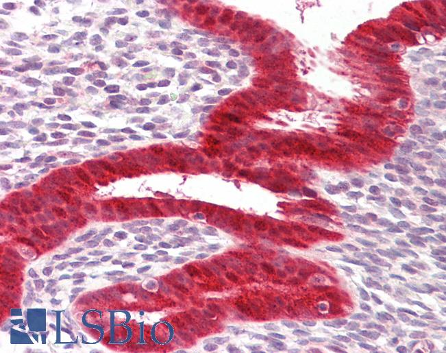 Anti-RIG-1 / RIG-I antibody IHC of human uterus. Immunohistochemistry of formalin-fixed, paraffin-embedded tissue after heat-induced antigen retrieval. Antibody LS-B8006 dilution 5-10 ug/ml.