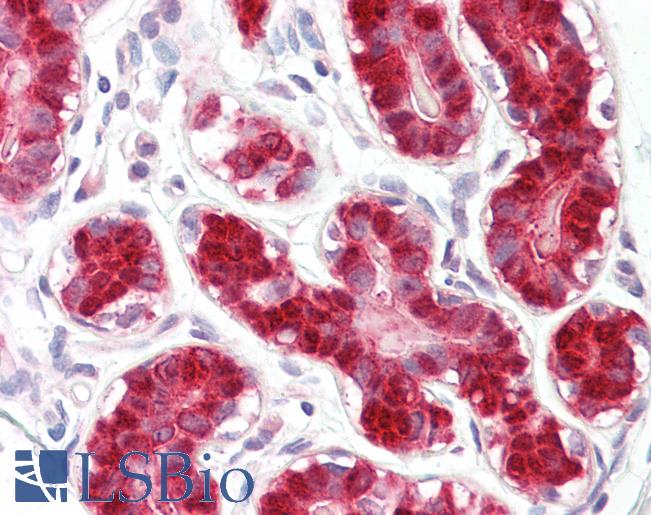 Anti-RIG-1 / RIG-I antibody IHC of human breast. Immunohistochemistry of formalin-fixed, paraffin-embedded tissue after heat-induced antigen retrieval. Antibody LS-B8006 dilution 5-10 ug/ml.
