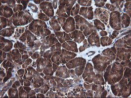 IHC of paraffin-embedded Human pancreas tissue using anti-DDX58 mouse monoclonal antibody.