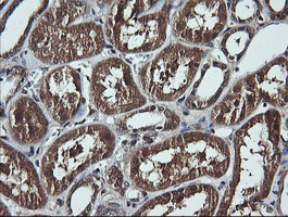 IHC of paraffin-embedded Human Kidney tissue using anti-DDX58 mouse monoclonal antibody.