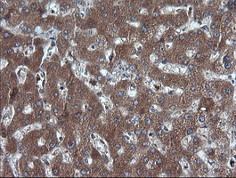 IHC of paraffin-embedded Human liver tissue using anti-DDX58 mouse monoclonal antibody.