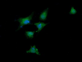 Anti-DDX58 mouse monoclonal antibody immunofluorescent staining of COS7 cells transiently transfected by pCMV6-ENTRY DDX58.
