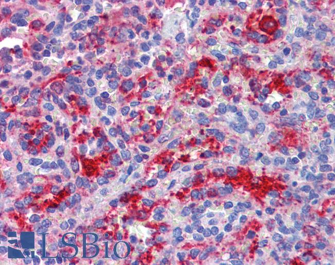 Anti-DDX58 antibody IHC of human spleen. Immunohistochemistry of formalin-fixed, paraffin-embedded tissue after heat-induced antigen retrieval. Antibody LS-B3768 concentration 3.75 ug/ml.