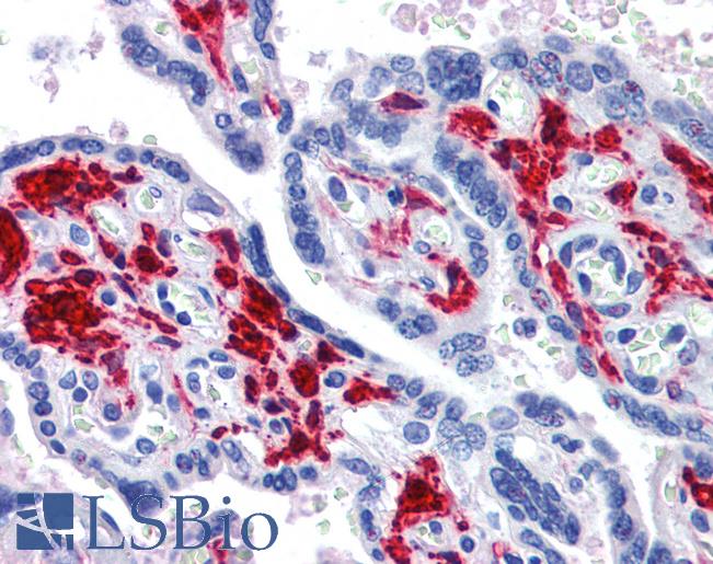 Anti-DDX58 antibody IHC of human placenta. Immunohistochemistry of formalin-fixed, paraffin-embedded tissue after heat-induced antigen retrieval. Antibody LS-B3768 concentration 3.75 ug/ml.