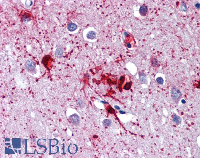 Anti-DDX58 antibody IHC of human brain, cortex. Immunohistochemistry of formalin-fixed, paraffin-embedded tissue after heat-induced antigen retrieval. Antibody LS-B3768 concentration 3.75 ug/ml.