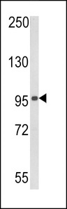 Western blot of DDX58 in 293 cell line lysates (35 ug/lane). DDX58 (arrow) was detected using the purified antibody.
