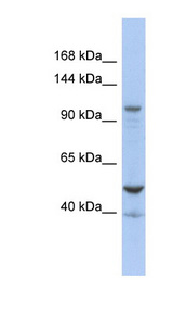 DDX58 antibody LS-C110155 Western blot of OVCAR-3 cell lysate.