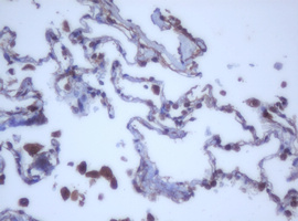 IHC of paraffin-embedded Human lung tissue using anti-DDX59 mouse monoclonal antibody.