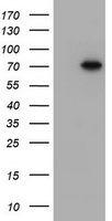 HEK293T cells were transfected with the pCMV6-ENTRY control (Left lane) or pCMV6-ENTRY DDX59 (Right lane) cDNA for 48 hrs and lysed. Equivalent amounts of cell lysates (5 ug per lane) were separated by SDS-PAGE and immunoblotted with anti-DDX59.