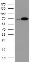 HEK293T cells were transfected with the pCMV6-ENTRY control (Left lane) or pCMV6-ENTRY DDX59 (Right lane) cDNA for 48 hrs and lysed. Equivalent amounts of cell lysates (5 ug per lane) were separated by SDS-PAGE and immunoblotted with anti-DDX59.