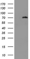 HEK293T cells were transfected with the pCMV6-ENTRY control (Left lane) or pCMV6-ENTRY DDX59 (Right lane) cDNA for 48 hrs and lysed. Equivalent amounts of cell lysates (5 ug per lane) were separated by SDS-PAGE and immunoblotted with anti-DDX59.