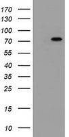 HEK293T cells were transfected with the pCMV6-ENTRY control (Left lane) or pCMV6-ENTRY DDX59 (Right lane) cDNA for 48 hrs and lysed. Equivalent amounts of cell lysates (5 ug per lane) were separated by SDS-PAGE and immunoblotted with anti-DDX59.