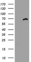 HEK293T cells were transfected with the pCMV6-ENTRY control (Left lane) or pCMV6-ENTRY DDX59 (Right lane) cDNA for 48 hrs and lysed. Equivalent amounts of cell lysates (5 ug per lane) were separated by SDS-PAGE and immunoblotted with anti-DDX59.