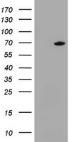 HEK293T cells were transfected with the pCMV6-ENTRY control (Left lane) or pCMV6-ENTRY DDX59 (Right lane) cDNA for 48 hrs and lysed. Equivalent amounts of cell lysates (5 ug per lane) were separated by SDS-PAGE and immunoblotted with anti-DDX59.