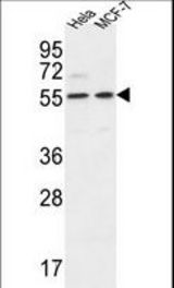 DDX6 Antibody western blot of HeLa,MCF-7 cell line lysates (35 ug/lane). The DDX6 antibody detected the DDX6 protein (arrow).