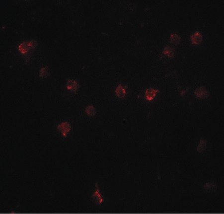 Immunofluorescence of DDX60 in A20 cells with DDX60 antibody at 20 ug/ml.