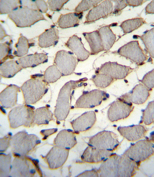 DDX60L Antibody immunohistochemistry of formalin-fixed and paraffin-embedded human skeletal muscle followed by peroxidase-conjugated secondary antibody and DAB staining.