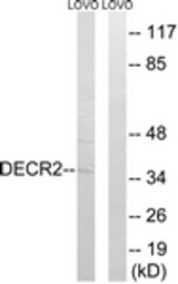 Western blot of extracts from LOVO cells, using DECR2 Antibody. The lane on the right is treated with the synthesized peptide.