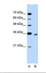 Lane A: Marker. Lane B: Jurkat cell lysate. Antibody concentration: 5.0 ug/ml. Gel concentration: 12%.