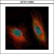 Confocal immunofluorescence analysis (Olympus FV10i) of paraformaldehyde-fixed HeLa using DEDD antibody (Green) at 1:500 dilution. Alpha-tubulin filaments were labeled with alpha-tubulin antibody (Red) at 1:2500.