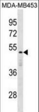 DEDD Antibody western blot of MDA-MB453 cell line lysates (35 ug/lane). The DEDD antibody detected the DEDD protein (arrow).