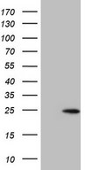 HEK293T cells were transfected with the pCMV6-ENTRY control (Left lane) or pCMV6-ENTRY CLDN3 (Right lane) cDNA for 48 hrs and lysed. Equivalent amounts of cell lysates (5 ug per lane) were separated by SDS-PAGE and immunoblotted with anti-CLDN3.