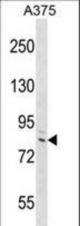 DEF6 Antibody western blot of A375 cell line lysates (35 ug/lane). The DEF6 antibody detected the DEF6 protein (arrow).
