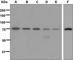 Western blot analysis on (A) human tonsil, (B) Ramos, (C) Molt-4, (D) human thymus (E) Raji, and (F) Jurkat lysates using anti-DEF6 antibody.