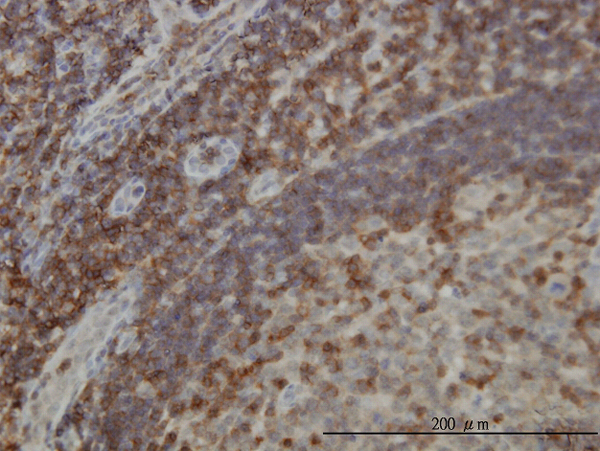 Immunoperoxidase of monoclonal antibody to DEF6 on formalin-fixed paraffin-embedded human lymph node [antibody concentration 3 ug/ml].