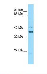 Western blot of Human 293T. DEF6 antibody dilution 1.0 ug/ml.