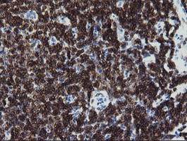 IHC of paraffin-embedded Human tonsil using anti-DEF6 mouse monoclonal antibody.