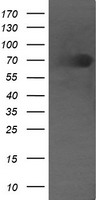 HEK293T cells were transfected with the pCMV6-ENTRY control (Left lane) or pCMV6-ENTRY DEF6 (Right lane) cDNA for 48 hrs and lysed. Equivalent amounts of cell lysates (5 ug per lane) were separated by SDS-PAGE and immunoblotted with anti-DEF6.