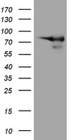 HEK293T cells were transfected with the pCMV6-ENTRY control (Left lane) or pCMV6-ENTRY DEF6 (Right lane) cDNA for 48 hrs and lysed. Equivalent amounts of cell lysates (5 ug per lane) were separated by SDS-PAGE and immunoblotted with anti-DEF6.