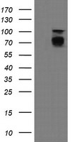 HEK293T cells were transfected with the pCMV6-ENTRY control (Left lane) or pCMV6-ENTRY DEF6 (Right lane) cDNA for 48 hrs and lysed. Equivalent amounts of cell lysates (5 ug per lane) were separated by SDS-PAGE and immunoblotted with anti-DEF6.