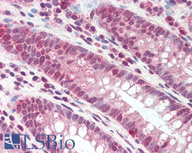 Anti-DEFB107A antibody IHC staining of human colon. Immunohistochemistry of formalin-fixed, paraffin-embedded tissue after heat-induced antigen retrieval. Antibody LS-B10350 concentration 5 ug/ml.