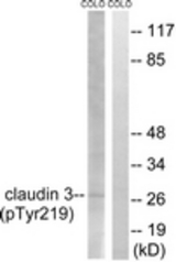 Western blot of extracts from COLO205 cells treated with EGF 200ng/ml 30', using Claudin 3 (Phospho-Tyr219) Antibody. The lane on the right was incubated with synthetic peptide.