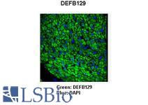 DEFB129 antibody Immunohistochemistry of pig bronchus smooth muscle.