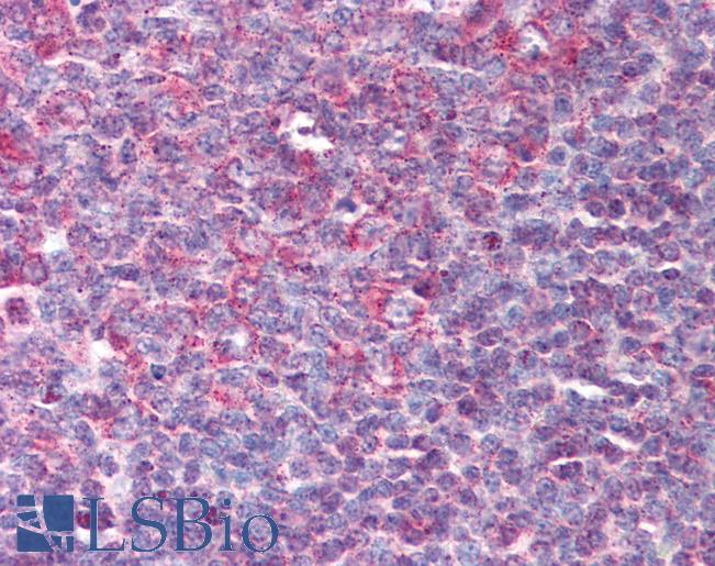 Anti-Beta Defensin 3 antibody IHC of human tonsil. Immunohistochemistry of formalin-fixed, paraffin-embedded tissue after heat-induced antigen retrieval. Antibody LS-B86 concentration 10 ug/ml.